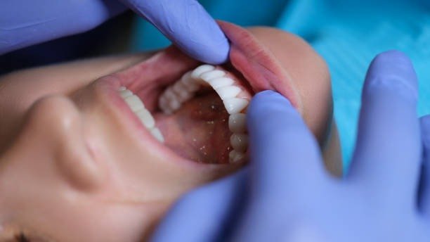 How Often Should Your Family Visit the Dentist?