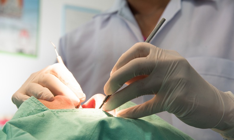 How Is Oral Surgery Recovery Managed?